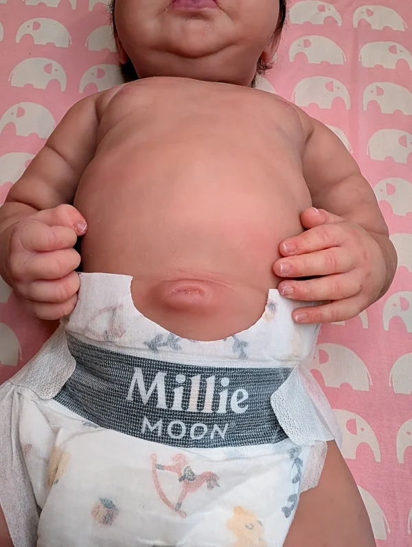 Baby Emily