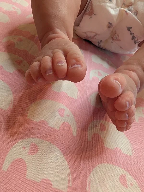Baby Emily