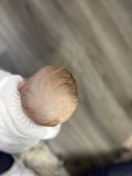 h3 BABY HAZEL